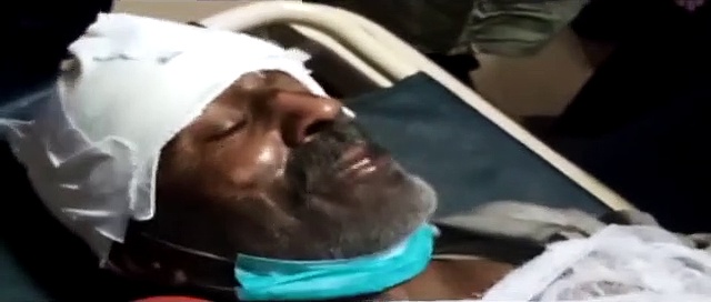 سانحہ تیزگام: متاثرہ زخمی مسافر کا میڈیا کو بیان