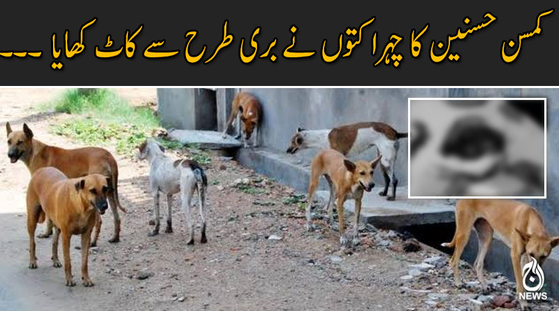 بچے کی حالت شدید تشویشناک، ڈاکٹروں نے 72 گھنٹے اہم قرار دے دیے