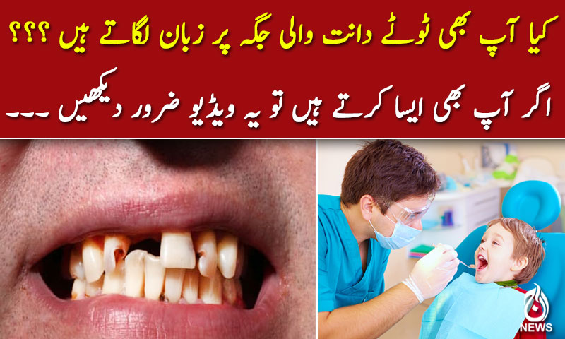 کیا آپ بھی ٹوٹے دانت والی جگہ پر زبان لگاتے ہیں؟