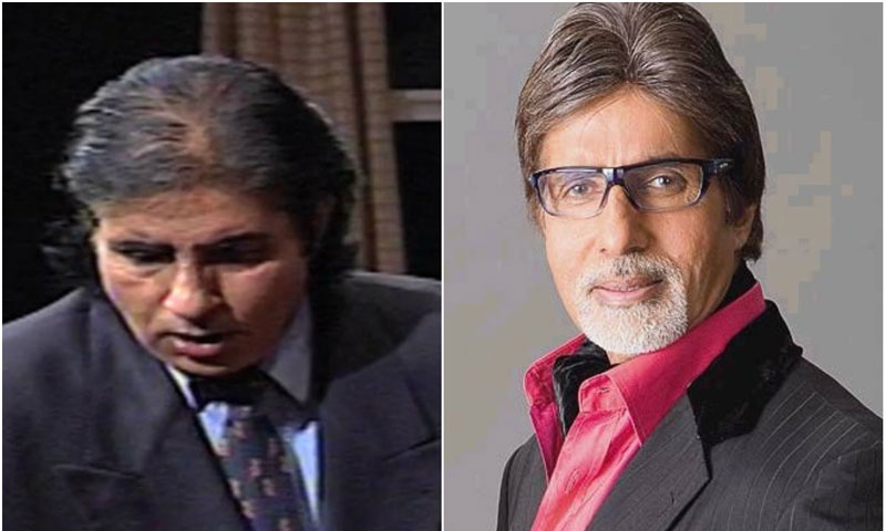 بال لگوانے والے مشہور اداکار