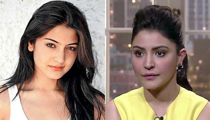 انوشکا شرما کا ہونٹوں کی سرجری کروانے کا مقصد سامنے آگیا