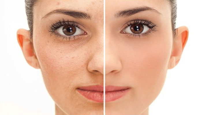 جھریاں دور کرنے کا یہ جادوئی طریقہ شاید آپ نہیں جانتے ہونگے