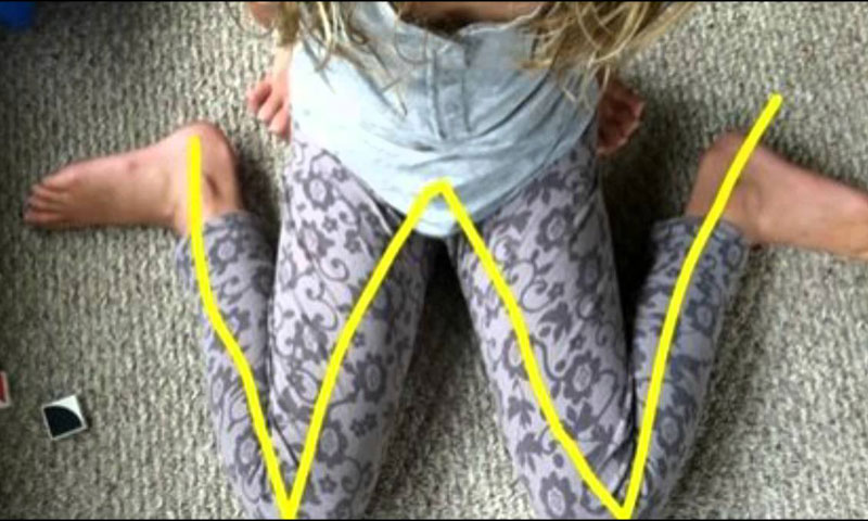 کیا آپ کو معلوم ہے کہ بچوں کا اس انداز میں بیٹھنا خطرے سے خالی نہیں