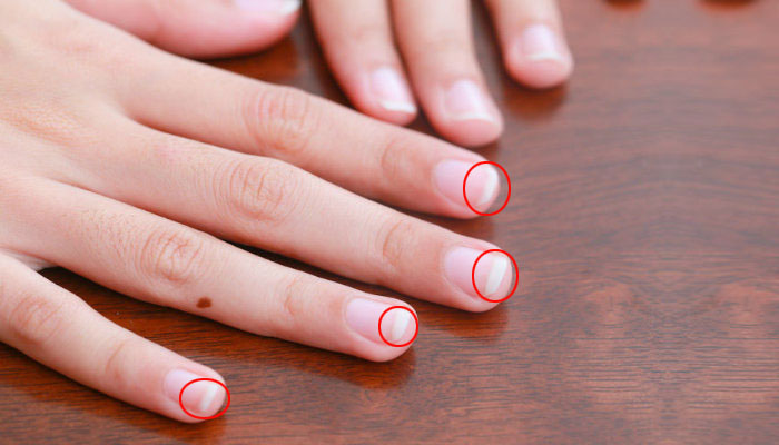 ناخنوں کا بڑھا ہوا حصہ سفید کیوں ہوتا ہے؟