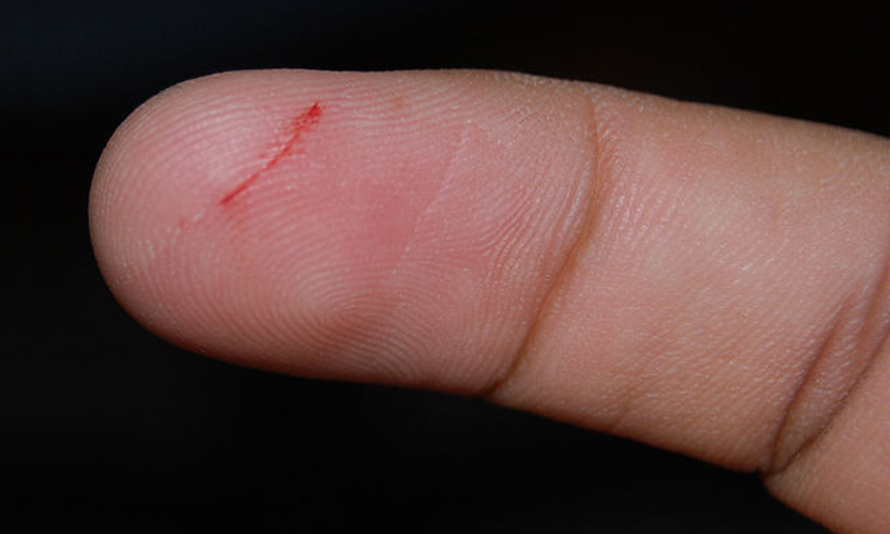 کاغذ سے ہاتھ کیوں کٹ جاتا ہے؟