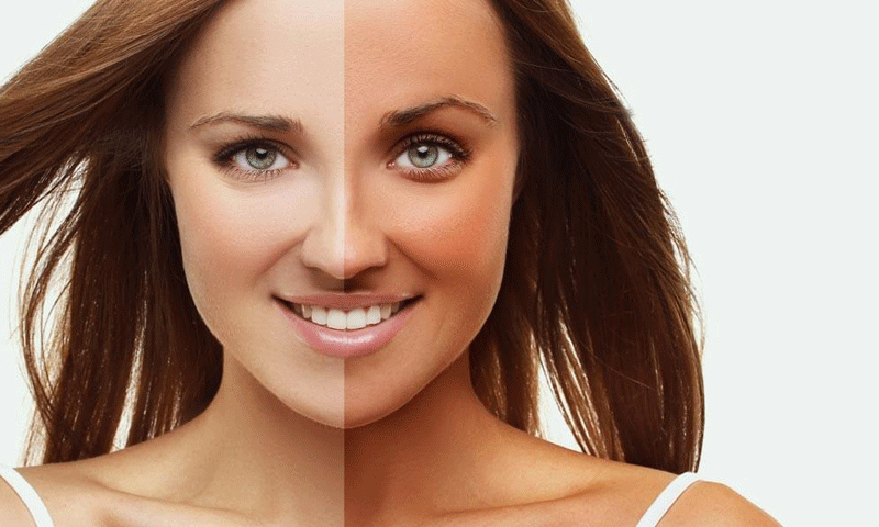 صرف ان تین طریقوں سے جھلسی ہوئی جلد سے چھٹکارا پائیں