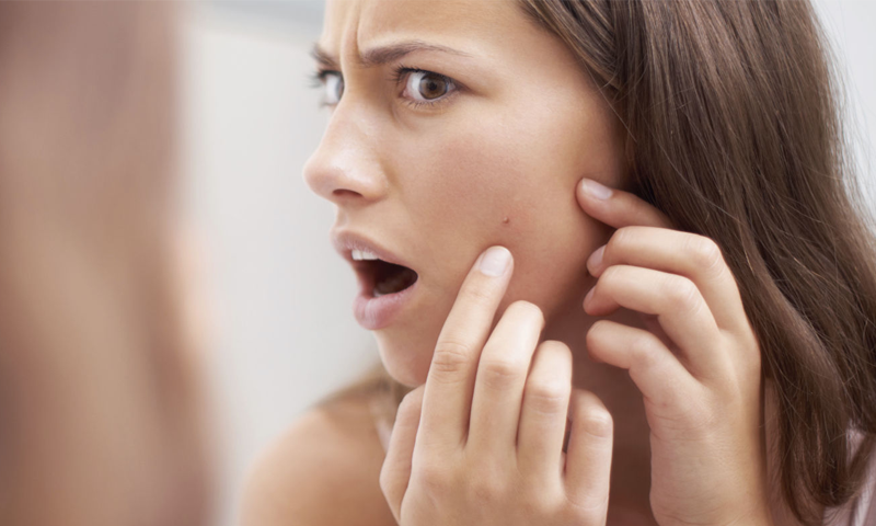 اب بلیک ہیڈز سے پریشان ہونے کی بالکل ضرورت نہیں