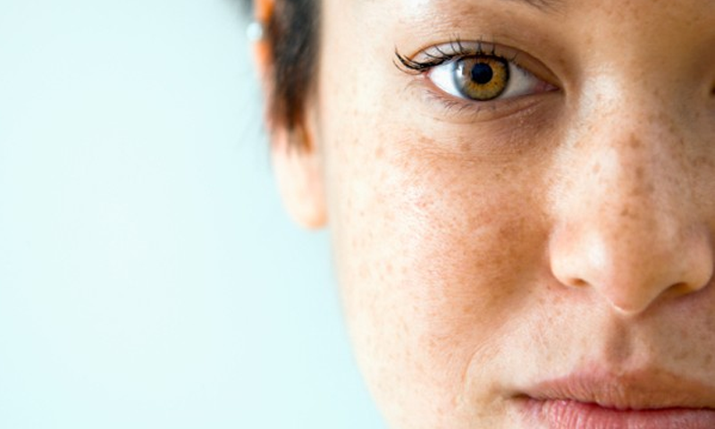 جلد پر موجود براؤن داغ کو دور بھگائیں