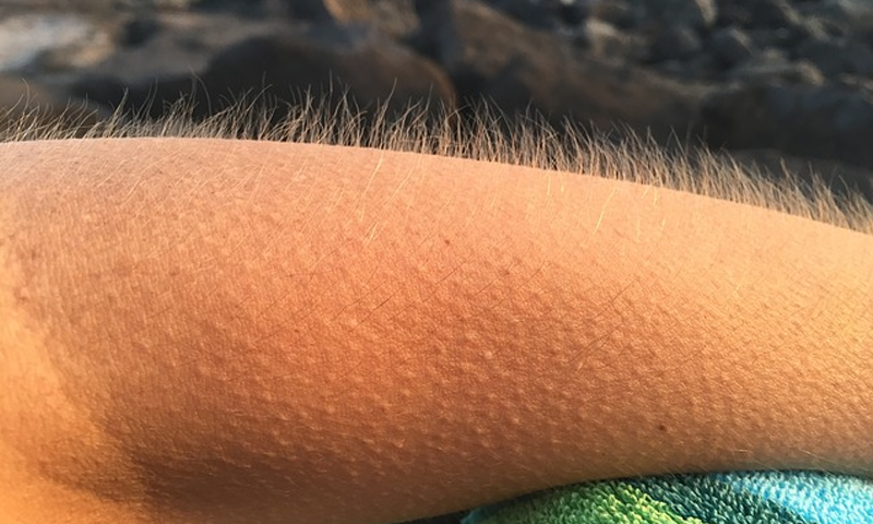 انسانی جلد پر رونگٹےکیوں نمودار ہوتے ہیں؟