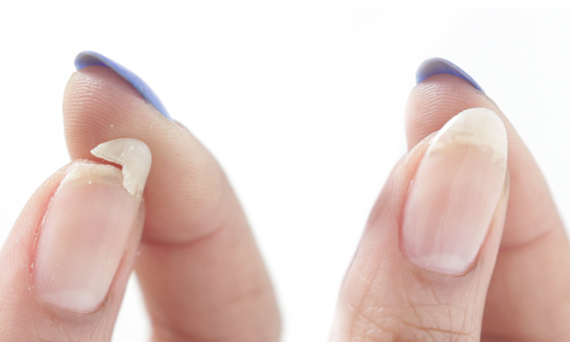 اگر پارٹی میں جاتے وقت ناخن ٹوٹ جائے تو اس کو فوراً کیسے جوڑا جائے؟