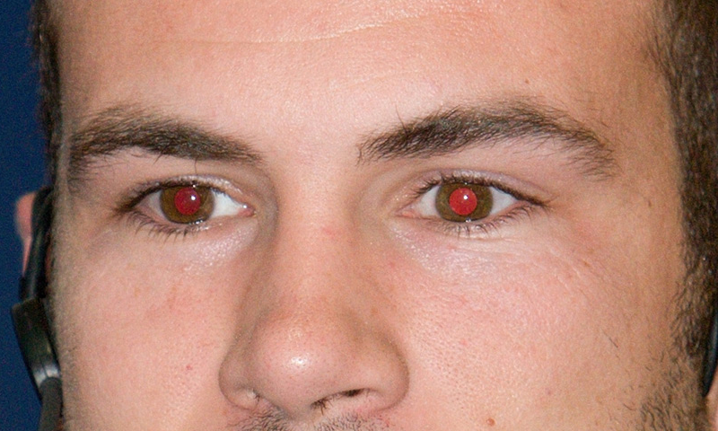 کیا آپ کی آنکھیں بھی تصویروں میں لال آتی ہیں؟