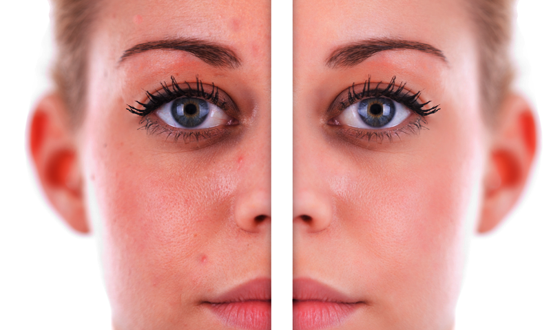 آپ کی ایسی عادات جو کررہی ہیں آپ کی جلد کو خراب