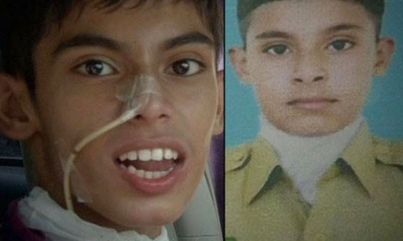 لاڑکانہ: مفلوج طالب علم  پر مبینہ تشدد کی تحقیقات میں تیزی