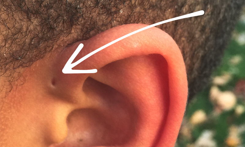 کان کے پاس یہ&nbsp; پُراسرار سوراخ کیوں ہوتا ہے؟