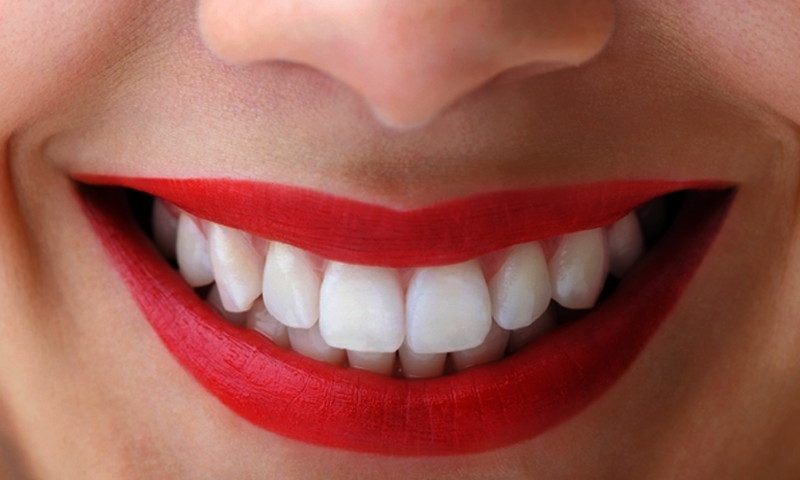 دانتوں میں جمع ٹارٹر اس جادوئی ترکیب سے دور بھگائیں