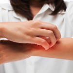 مچھر دوسروں کے مقابلے میں آپ کو زیادہ کاٹتے ہیں؟