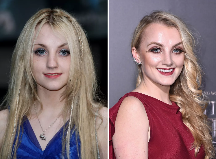 کی کاسٹ اب کیسی دکھتی ہے؟ Harry Potter