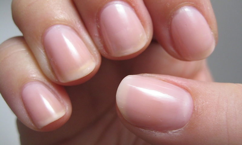 صحت مندناخن چاہتے ہیں تو ان 5چیزوں پر عمل کیجئے