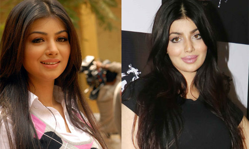 ہونٹوں کی سرجری ،تصویر شیئر کرنے کے بعد عائشہ کو تمسخر کا سامنا