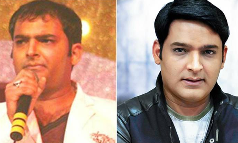 ہیئر ٹرانسپلانٹ سرجری کروانے والے 10 مشہور بولی وڈ اداکار