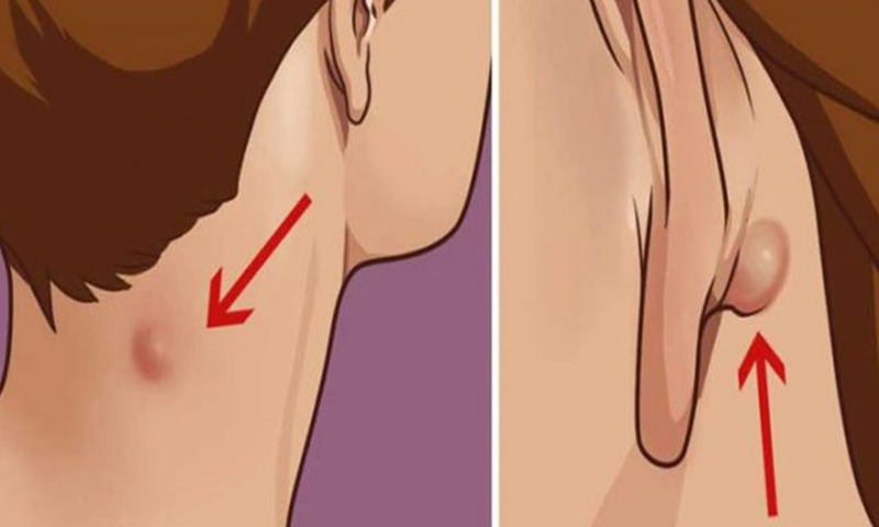 کان کے پیچھے بننے والی گٹھلی کے 7 &nbsp;گھریلو علاج