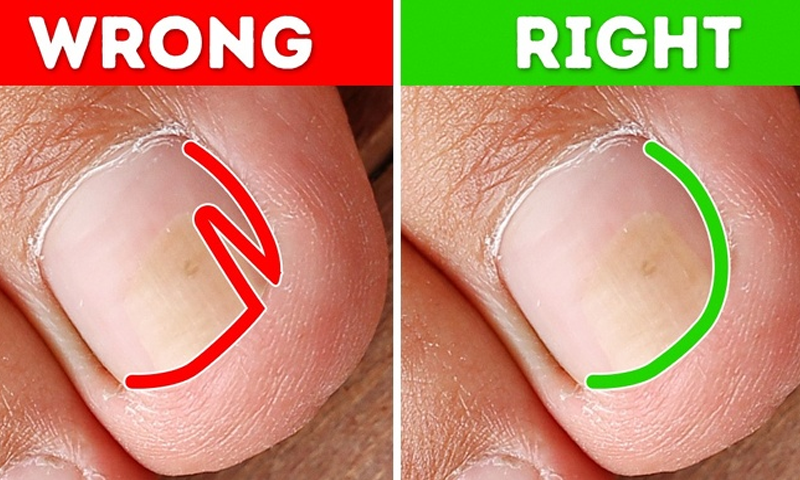 پیر کے ناخُن کی غیر معمولی پیداوار کا علاج کیسے کریں