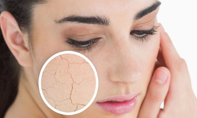 آج کا ٹوٹکا : جسم سے خشکی کا خاتمہ