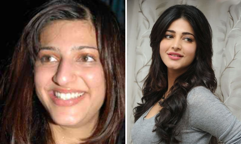 سرجری کے ذریعے مصنوعی خوبصورتی حاصل کرنے والی ساؤتھ انڈین اداکارائیں