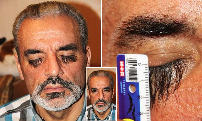 خواتین سُن لیں!!! لمبی پلکوں کا راز ہے اس شخص کے پاس