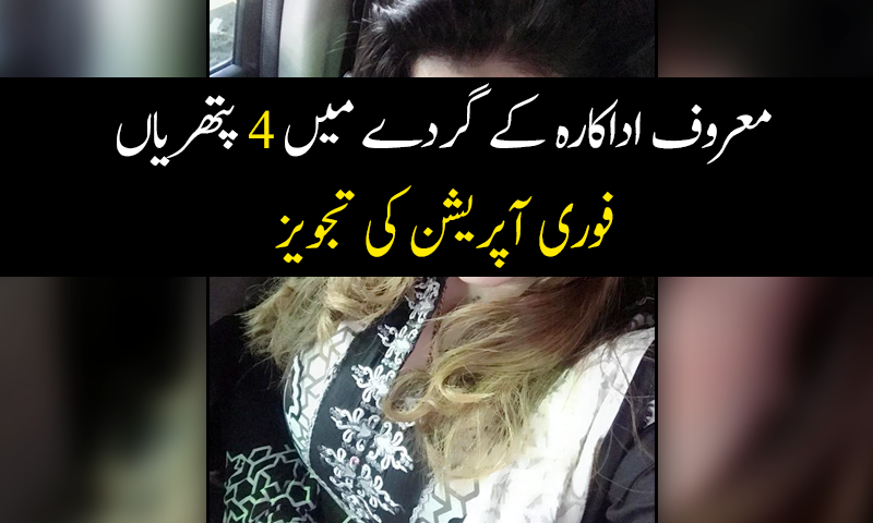 معروف اداکارہ کے گردے میں 4 پتھریاں، فوری آپریشن کی تجویز