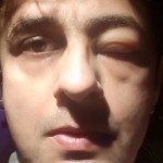 سونو نگم کا چہرہ بگڑنے کے بعد نیا بیان